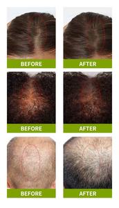 <span class=keywords><strong>Usman</strong></span> thiên nhiên tam giác 3 oz rắn dầu gội thanh làm dịu cỏ công thức chống gàu thảo dược chăm sóc tóc cho phụ nữ và nam giới - Product Image 5