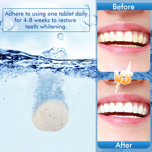 Blanqueamiento <span class=keywords><strong>de</strong></span> <span class=keywords><strong>dientes</strong></span> Etiqueta Privada <span class=keywords><strong>precio</strong></span> <span class=keywords><strong>de</strong></span> fábrica cuidado bucal respetuoso con el medio ambiente cuidado bucal tableta blanqueadora gratis para quitamanchas en el hogar - Product Image 4