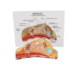 Anatomical Models 1:1 Median Section of Human Female Breast Pathology Anatomy Model Kit Table-type For Medical Education