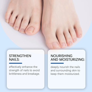 Funghi Out ape veleno per unghie soluzione trattamento a base di erbe antibatterico per la riparazione delle unghie essenza per la cura delle mani e dei piedi - Product Image 3