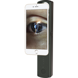 Equipo Oftalmológico: Lámpara de Hendidura Óptica Portátil / Lámpara de Hendidura Portátil de Mano / Lámpara de Hendidura Veterinaria Portátil - Product Image 1