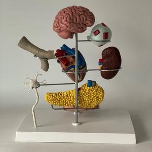 Modelo Anatómico de Patología de Diabetes Humana, Modelo de Enseñanza de 8 Partes, Modelo de Anatomía del Páncreas de Alta Calidad - Product Image 5