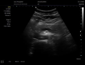 Mesin <span class=keywords><strong>Ultrasound</strong></span> SS-9B untuk dokter hewan/manusia Sonostar mesin <span class=keywords><strong>Ultrasound</strong></span> Laptop portabel - Product Image 4