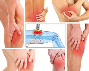 Máquina Portátil de Fisioterapia <span class=keywords><strong>Tecar</strong></span> Terapia RET MagicBelle para Alivio del Dolor en Mascotas y Humanos con Certificación CE - Product Image 3