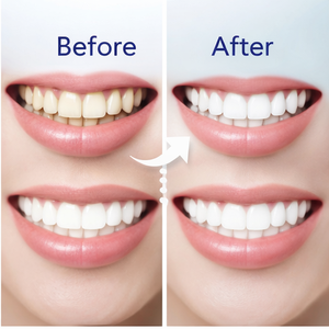 Dentifrice Nano Hydroxyapatite Sans Fluorure, Répare l'Émail, pour Dents Sensibles, Blanchissant, Soin Buccal, Menthe Fraîche - Product Image 2