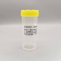 Tubo estéril de 60 ml para estabilización de orina con conservante para estabilización de ADN y ARN en biopsias líquidas