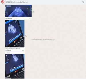 Machine SUN-906A d'ultrason vétérinaire de Doppler de couleur de couverture de sonde d'ultrason en Allemagne - Product Image 6