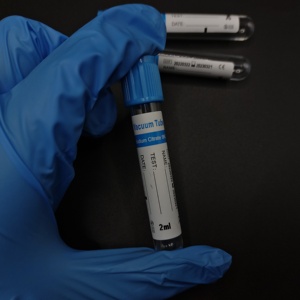 Tubo de Recolección de Sangre al Vacío PET Azul con Citrato de Sodio 9NC, 2ml 13*75mm, para Uso en Laboratorio, Precio al por Mayor - Product Image 5
