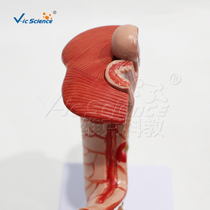Modèle anatomique gastrique pathologique de grande taille ; outil pédagogique pour l'étude des structures pathologiques de l'estomac humain. - Product Image 4