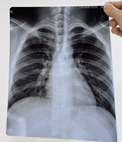 Baik retensi warna Asli Fujifilm medis x-ray pencitraan Film 8X10 10x12 10x14 14x17 inci Laser inframerah Film gastrskopik