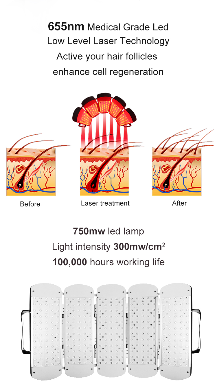 LED Hair Growth Treatment Machine Is Used To Stimulate Hair Regeneration And Improve Hair Condition.