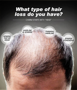 Your Logo Fibers Colors <strong>Hair</strong> Loss Treatment Fibre Fully Keratin Cotton <strong>Hair</strong> Building Fibers <strong>Powder</strong> Hold Spray - Product Image 2