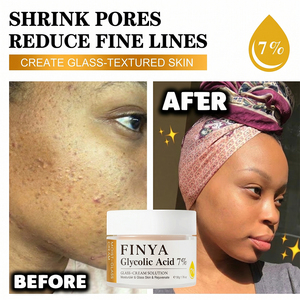 Meilleurs produits de soin de la peau, crème pour le <span class=keywords><strong>visage</strong></span> à l'acide glycolique, niacinamide, centella asiatica, hydratant, éclaircissant, réparateur, blanchissant - Product Image 3