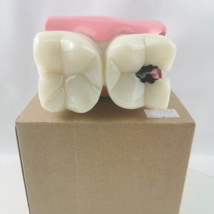 Modèle de dent à carie M4021 non amovible pour la formation et la pratique dentaire, couleur blanche, 233g, kit individuel - Product Image 3