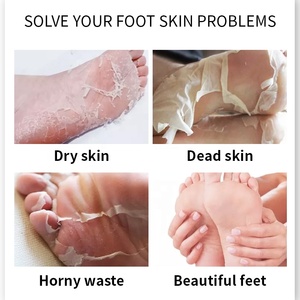 Prezzo basso all'ingrosso 40g Private Label maschera Peeling per la cura dei piedi biologica rimuovi la pelle morta maschera esfoliante per i piedi alla lavanda - Product Image 2