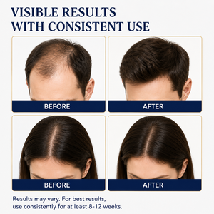 Espuma para el Crecimiento <span class=keywords><strong>del</strong></span> Cabello Seco Unisex de Marca Privada con Biotina para la <span class=keywords><strong>Caída</strong></span> <span class=keywords><strong>del</strong></span> Cabello, Crecimiento Más Denso y Voluminoso, Espuma sin Perfume - Product Image 3