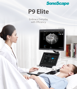 Sonoscape P9Elite Fonction IA Échographie Doppler couleur Diagnostique 21,5 pouces Haute résolution Gynécologie Cardiologie Appareil d'échographie - Product Image 2