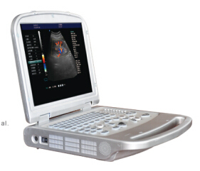 Sondas Convexas y Lineales, Escáner de Ultrasonido Doppler a Color para Laptop, Ultrasonido Veterinario, Máquina de Ultrasonido Portátil - Product Image 2