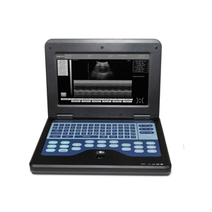 CONTEC CMS600P2 Échographe <span class=keywords><strong>Doppler</strong></span> portable numérique pas cher de 10,1 pouces, prix - Product Image 1