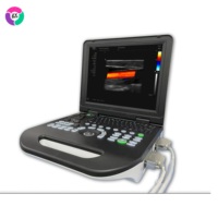 Échographe vétérinaire portable Zunyou ZY-E30 avec écran tactile pour diagnostic médical des animaux – Équipement de clinique vétérinaire pour la santé des animaux de compagnie