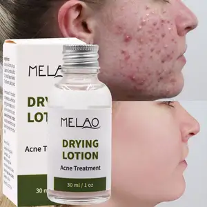 OEM/ODM High Quality Private Label Facial Care Natural Organic Acne Treatment MELAO Oil Balance Drying Lotion Acne Treatment
