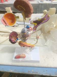 Model Patologi <span class=keywords><strong>Diabetes</strong></span> Manusia 8 Bagian untuk Pengajaran - Product Image 6