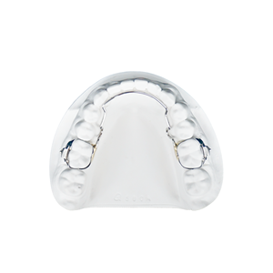 <span class=keywords><strong>Appareil</strong></span> d'expansion <span class=keywords><strong>dentaire</strong></span> amovible de classe II, plaque orthodontique en acrylique pour le redressement des dents, personnalisation - Product Image 5