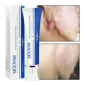 Mooyam creme de remoção de acne eficaz, creme de espinhas, estrias, gel para rosto, barriga, enrijecedor, creme de remoção de marcação