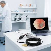 Endoscope médical USB haute définition 1080P portable à lumière froide avec grossissement 6x et fonction de congélation