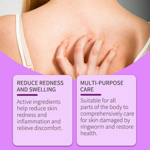 Pijat Tubuh Anti-Bakteri <span class=keywords><strong>Herbal</strong></span> untuk Tangan Kaki Tubuh Obat untuk Penggunaan Luar Kelas II untuk Pengobatan <span class=keywords><strong>Psoriasis</strong></span> Dermatitis Kulit - Product Image 5