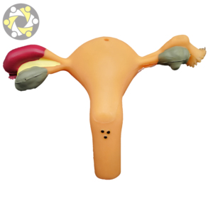 แบบจำลองกายวิภาคศาสตร์ของเนื้องอกมดลูกในผู้หญิง แบบจำลองกายวิภาคศาสตร์ของมดลูก - Product Image 4