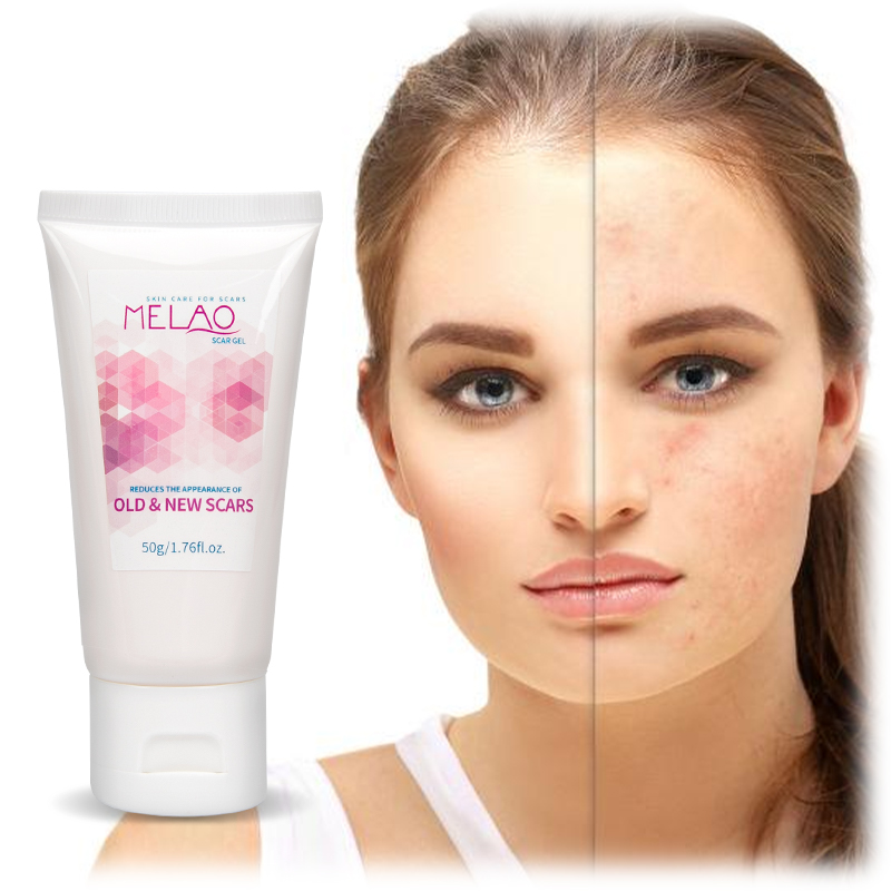 OEM/ODM MELAO частная торговая марка гель для удаления шрамов органический натуральный анти-акне уменьшает появление старых