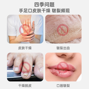 Liker White - Crema Hidratante Corporal de Uso Diario para Labios y Manos Secos y Agrietados - Product Image 4