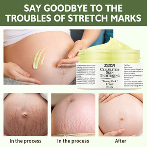 Crème corporelle raffermissante et nourrissante anti-cellulite, réparatrice des vergetures, éclaircissante à la vitamine C et au rétinol, marque privée avec logo personnalisé - Product Image 2
