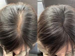 Supplément à base de plantes OEM pour aider à la croissance des cheveux Huile de graines noires Liquide oral Ginseng rouge Collagène Peptide Brillant Boisson pour la croissance des cheveux - Product Image 6