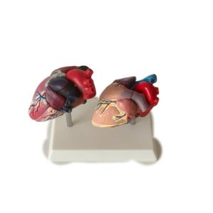 Maniquí de PVC avanzado de tamaño real para falla cardíaca patológica humana, con láminas arteriales vasculares y corazón anatómico saludable - Product Image 1