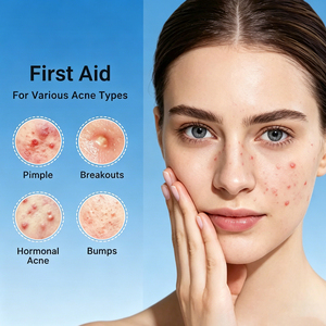 Sérum Visage Anti-âge et Anti-acné en Gros : Éclat, Réduction des Rides, Blanchissant, Apaisant et Nourrissant en Profondeur - Product Image 4