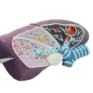 Modelo de pulmón patológico para fines de enseñanza médica - Product Image 6
