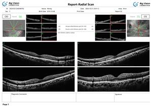 Tomografía <span class=keywords><strong>de</strong></span> Coherencia Óptica Económica, Escáner OCT <span class=keywords><strong>de</strong></span> Segmento Anterior y Posterior con Análisis por IA, Equipo <span class=keywords><strong>de</strong></span> Diagnóstico Oftálmico - Product Image 4