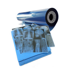 Prix de gros d'usine Film d'impression d'imagerie par rayons X PET Film sec de Base bleu médical étanche - Product Image 4