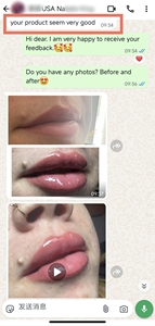 Wholesale <strong>Price</strong> <strong>Lips</strong> Rosy and Plump Safe <strong>Injectable</strong> HA Medical Grade Gel Filler <strong>with</strong> VB12 - Product Image 6