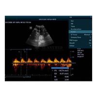 Instrument à ultrasons médical DP20 2D couleur Doppler ultrasons usage humain numérique Mindray BW ultrasons DP-20