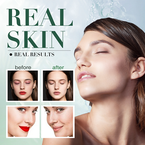 Veletine 2 in 1 Kruiden Make-up Remover Olie Reinigende Acne Controle Hydraterende Huidverzorging Gezichtsreiniger 150ml Alle Huidtypen - Product Image 4