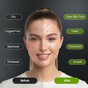 <span class=keywords><strong>Mascarilla</strong></span> Facial Peel-Off <span class=keywords><strong>de</strong></span> Carbón Activado, Orgánica, Herbal, con Aloe Vera, Limpieza Profunda, Elimina Puntos Negros, <span class=keywords><strong>para</strong></span> Todo Tipo <span class=keywords><strong>de</strong></span> Piel - Product Image 6