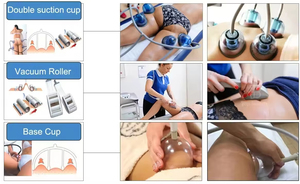 Mesin Vakum Starvac SP2 Vacuum Cup Roller Pijat Pelangsing Tubuh Pengangkat Bokong Peralatan Pembesar Payudara - Product Image 3