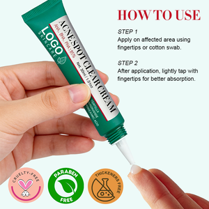 Crema para el Acné de Marca Privada que Combate las Espurros, Calma el Enrojecimiento, Hidrata Profundamente, Aclara las Marcas del Acné, Crema Suave para el Acné - Product Image 6