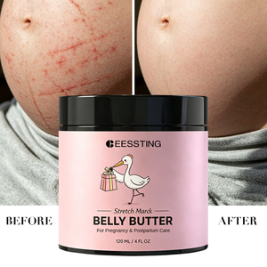 Loción Corporal Suave y Segura para el Cuidado de la Maternidad al por Mayor, Hidratante y Reafirmante para Piel Suave del Vientre de Embarazadas, Mantequilla para Estrías del Vientre - Product Image 2