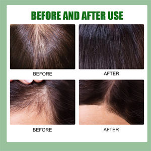 EELHOE 20ml Angelica Black Sesame Ginger Spray para el crecimiento del cabello Anti Pérdida <span class=keywords><strong>Alopecia</strong></span> <span class=keywords><strong>Areata</strong></span> <span class=keywords><strong>Alopecia</strong></span> seborreica Suero para el cabello para crecer - Product Image 3