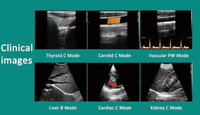 Échographe Doppler Couleur Sans Fil à Double Têtes Convexes et Linéaires 3-en-1 pour Usage Cardiaque