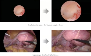 Système de caméra d'endoscopie vidéo médicale Mindray série UX1 haute résolution pour usage vétérinaire - Product Image 6